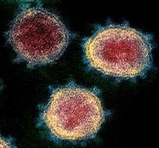 From NIAID-RML [CC BY 2.0]